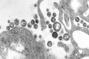 Un cas de virus lassa d&eacute;couvert au Togo