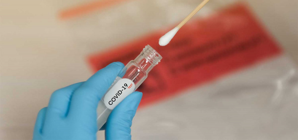 Coronavirus: Togo plans to proceed to random large-scale testing soon
