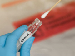 Coronavirus: Togo plans to proceed to random large-scale testing soon