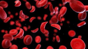 Togo : des solutions innovantes pour renforcer la lutte contre la dr&eacute;panocytose