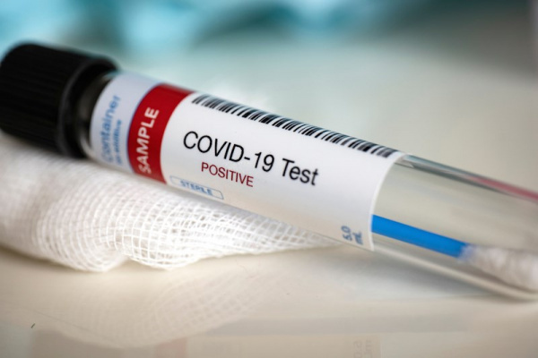 Coronavirus: Togolese government selects five free testing sites for suspected cases