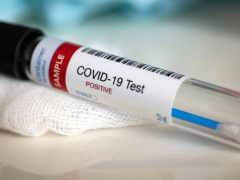 Coronavirus: Togolese government selects five free testing sites for suspected cases